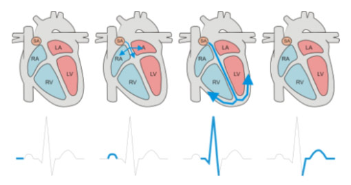 Schematic explanation of  RA, LA, RV, LV parameters and their visualization on Heart Rate