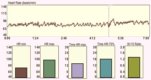 Example of an Orthostatic Test report in Heart Rhythm Scanner SE